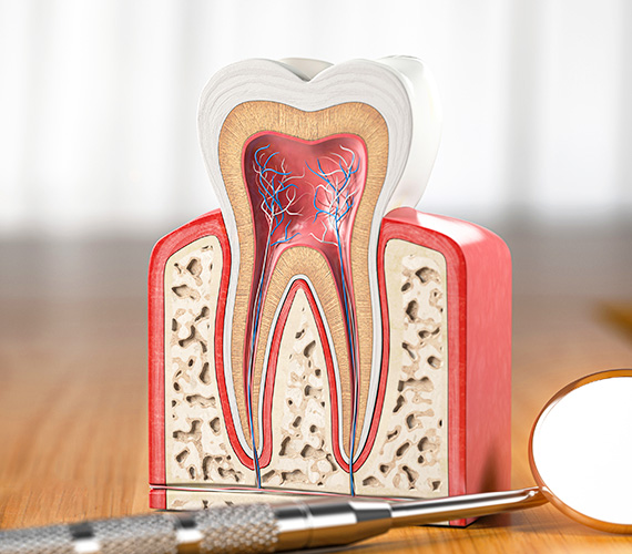 根管治療（歯内療法）